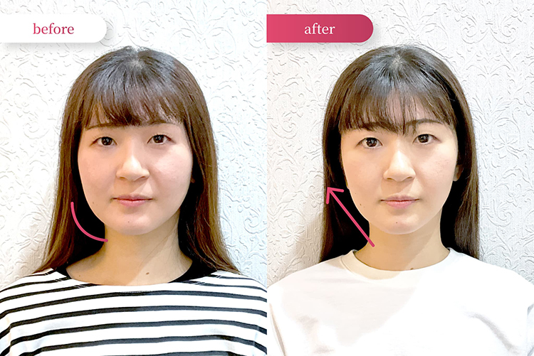 ビフォーアフター